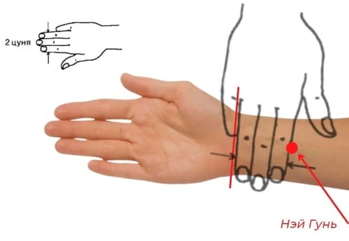 акупрессура внутренних пограничных ворот (Нэй гуань)