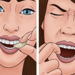 Чеснок от зубной боли: применение и меры предосторожности